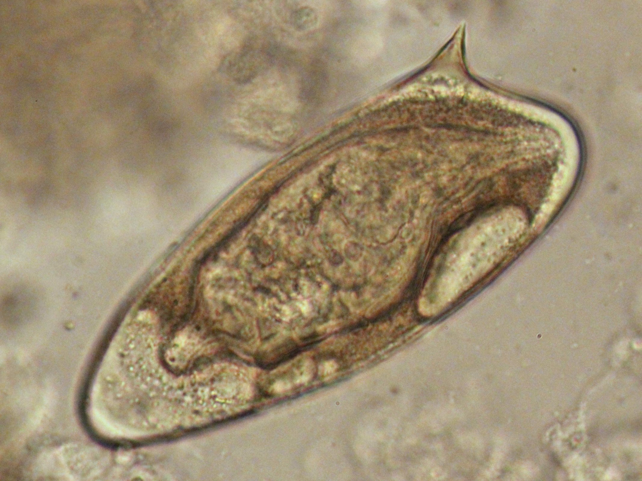 schistosomiasis férgek