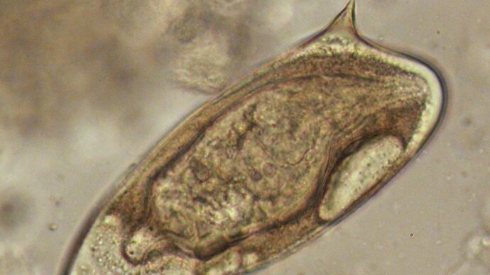 S.mansoni egg with lateral spine.Copyright Trustees of the Natural History Museum,London