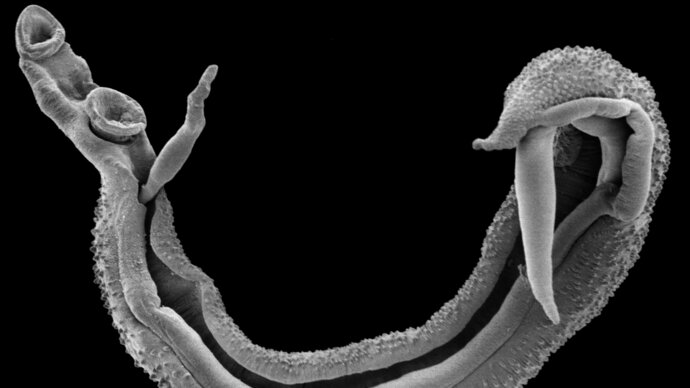 A scanning electron micropscope image of the a schistosome worm pair. Copyight Trustees of the Natural History Museum, London